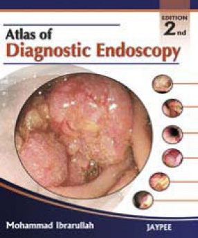 Atlas of Diagnostic Endoscopy