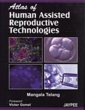 Atlas of Human Assisted Reproductive Technologies 