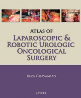 Atlas of Laparoscopic and Robotic Urologic Oncological Surgery 