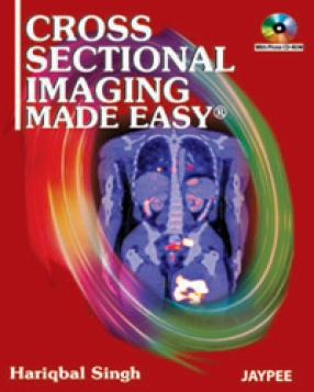 Cross Sectional Imaging Made Easy 
