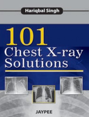 101 Chest X-Ray Solutions 