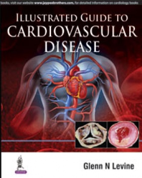 Illustrated Guide to Cardiovascular Disease 