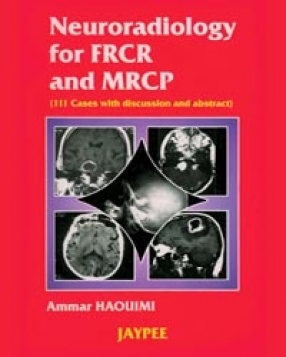 Neuroradiology for FRCR and MRCP 